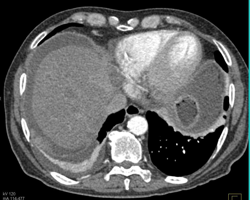 CTisus Case Studies