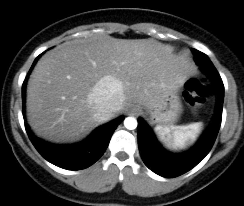 CTisus Case Studies