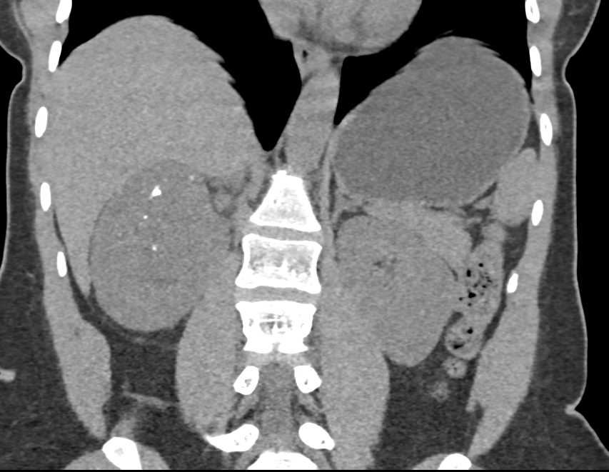 CTisus Case Studies