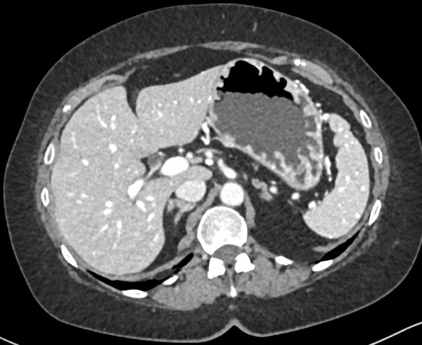 CTisus Case Studies