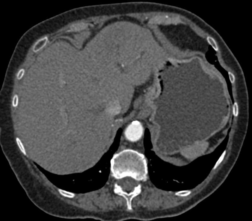 CTisus Case Studies