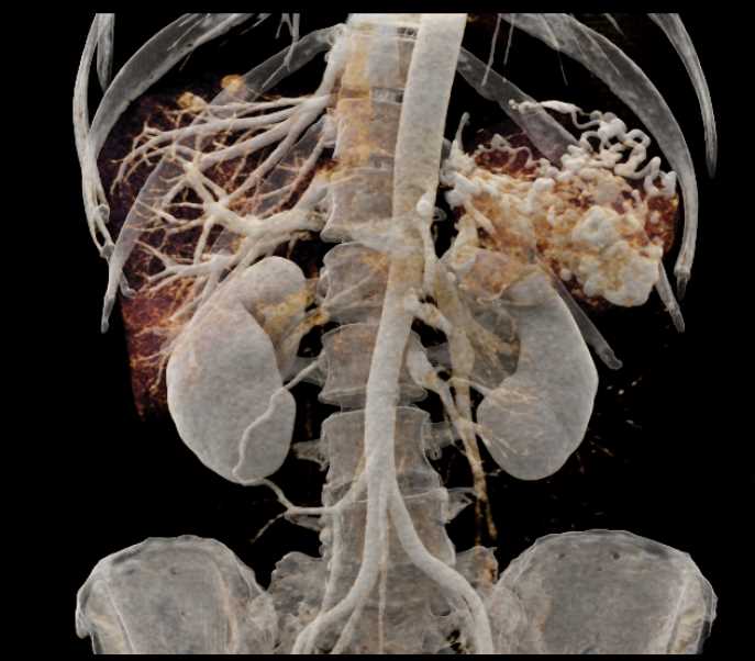 CTisus Case Studies