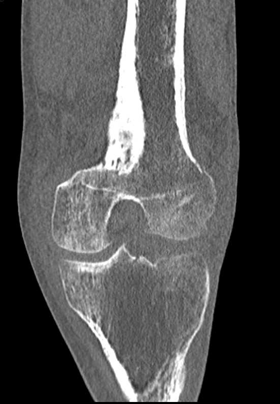 CTisus Case Studies