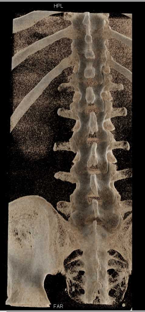 CTisus Case Studies