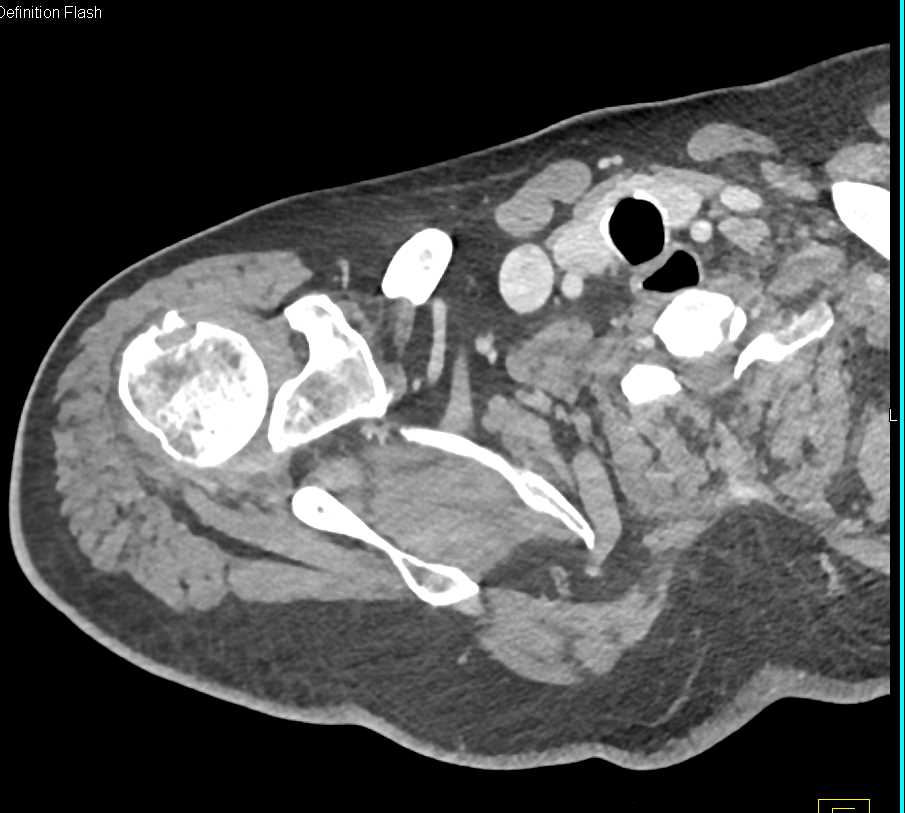 CTisus Case Studies