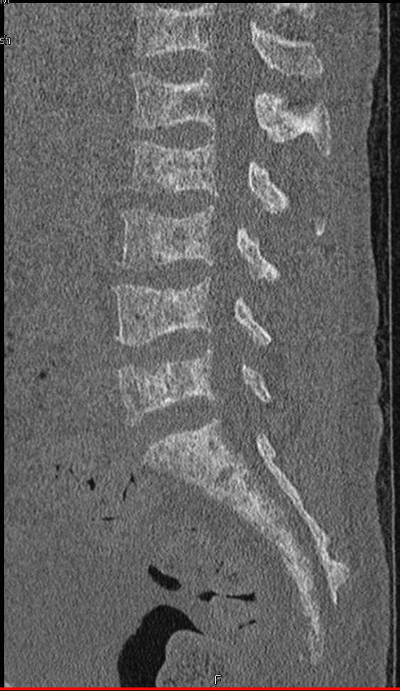 CTisus Case Studies