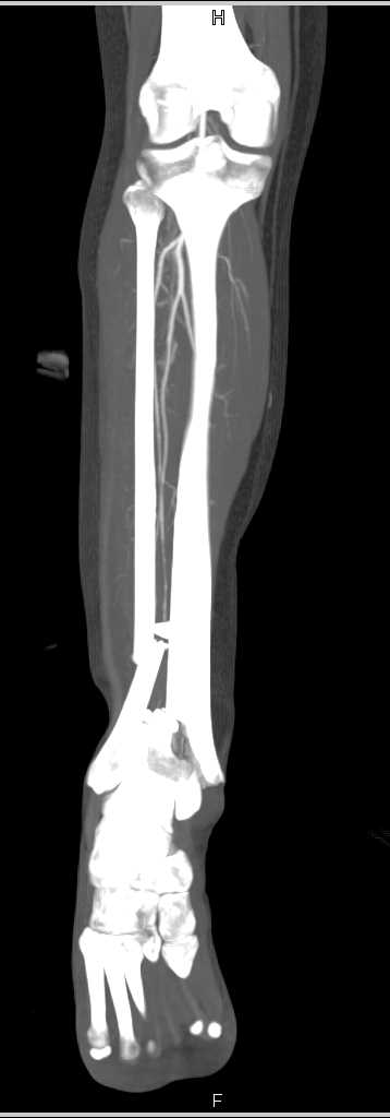 CTisus Case Studies