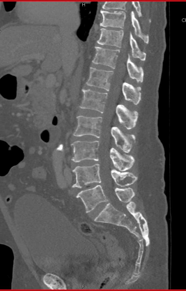 CTisus Case Studies