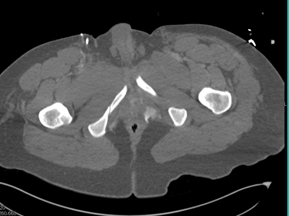 CTisus Case Studies