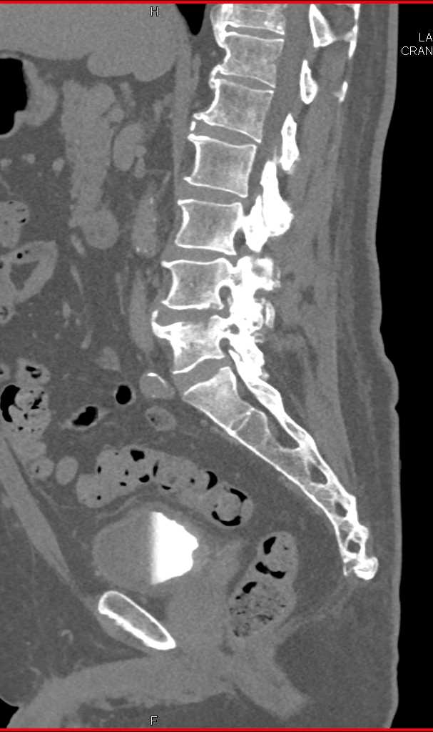 CTisus Case Studies