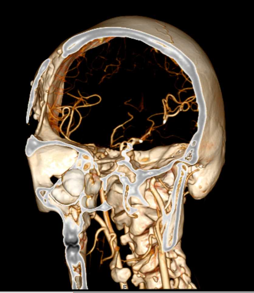 CTisus Case Studies