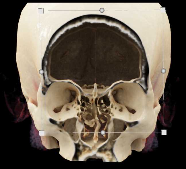 CTisus Case Studies