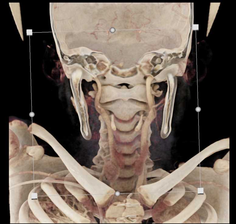 CTisus Case Studies