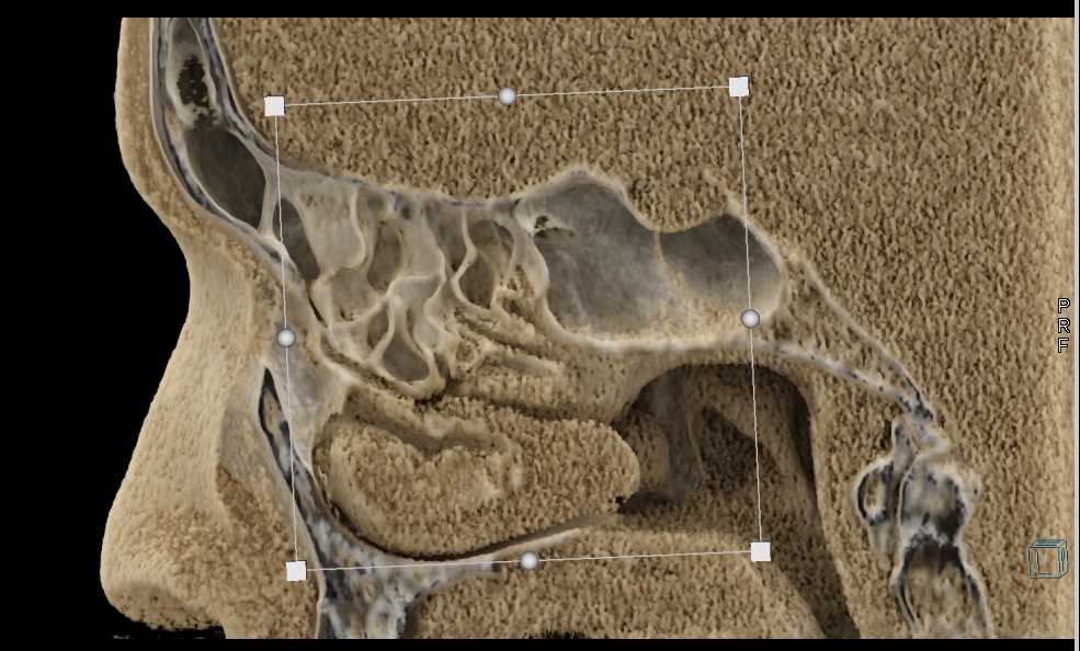 CTisus Case Studies