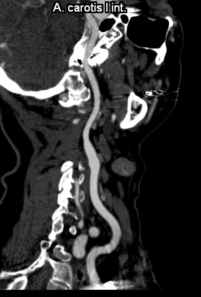 CTisus Case Studies