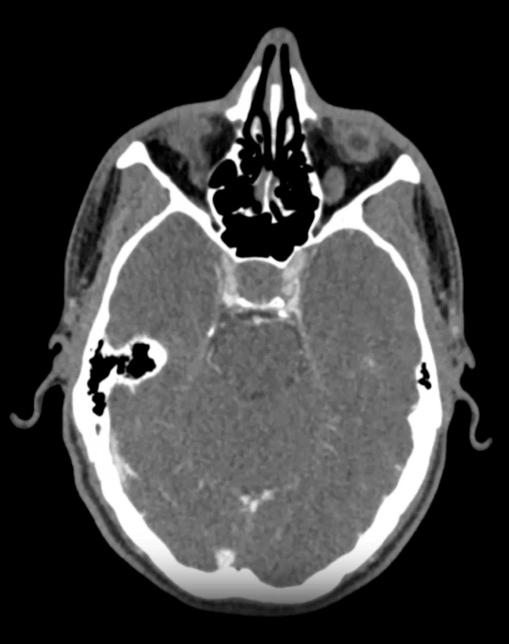 CTisus Case Studies