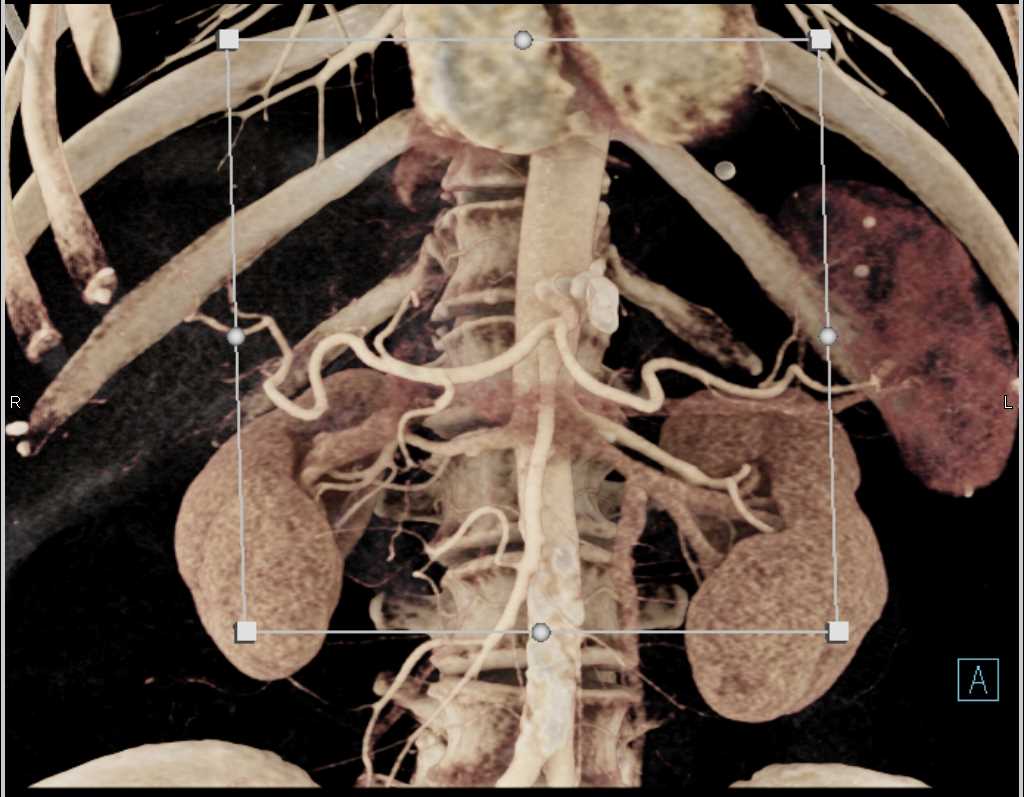 CTisus Case Studies