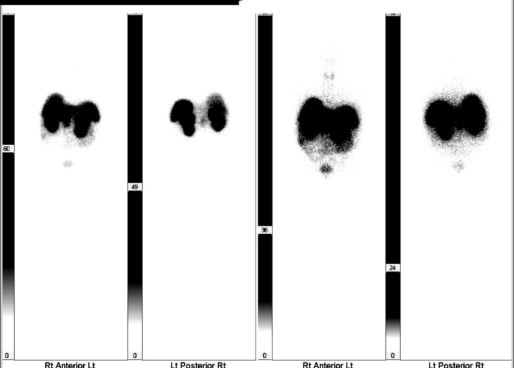 CTisus Case Studies