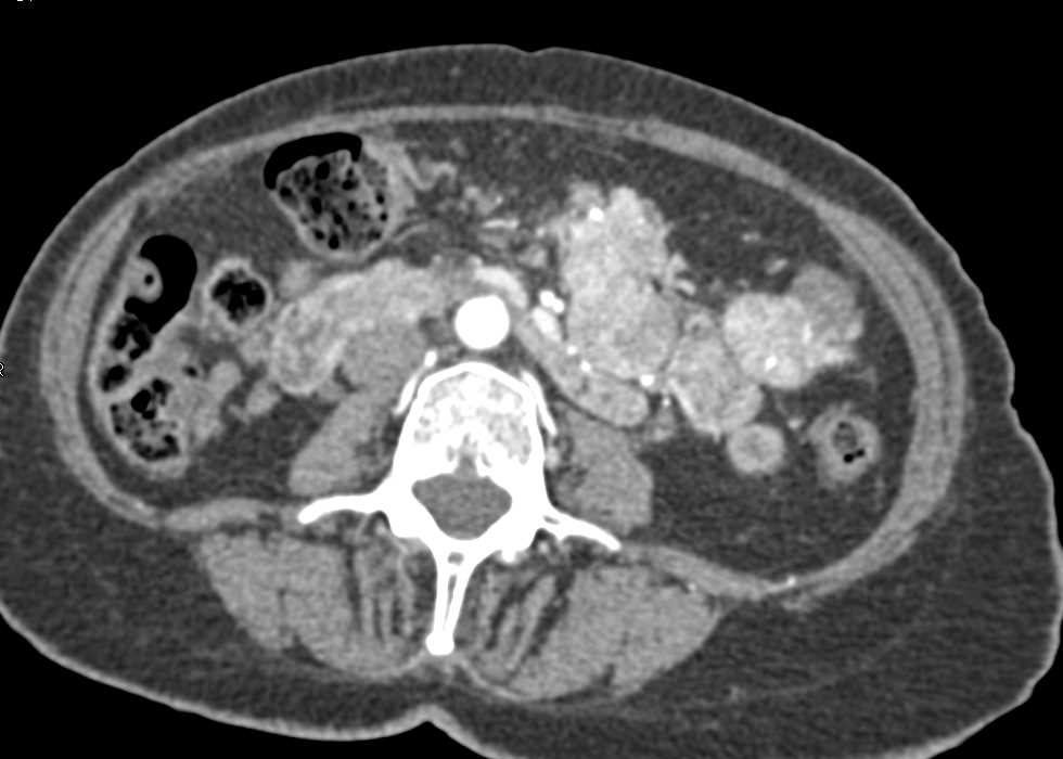 CTisus Case Studies