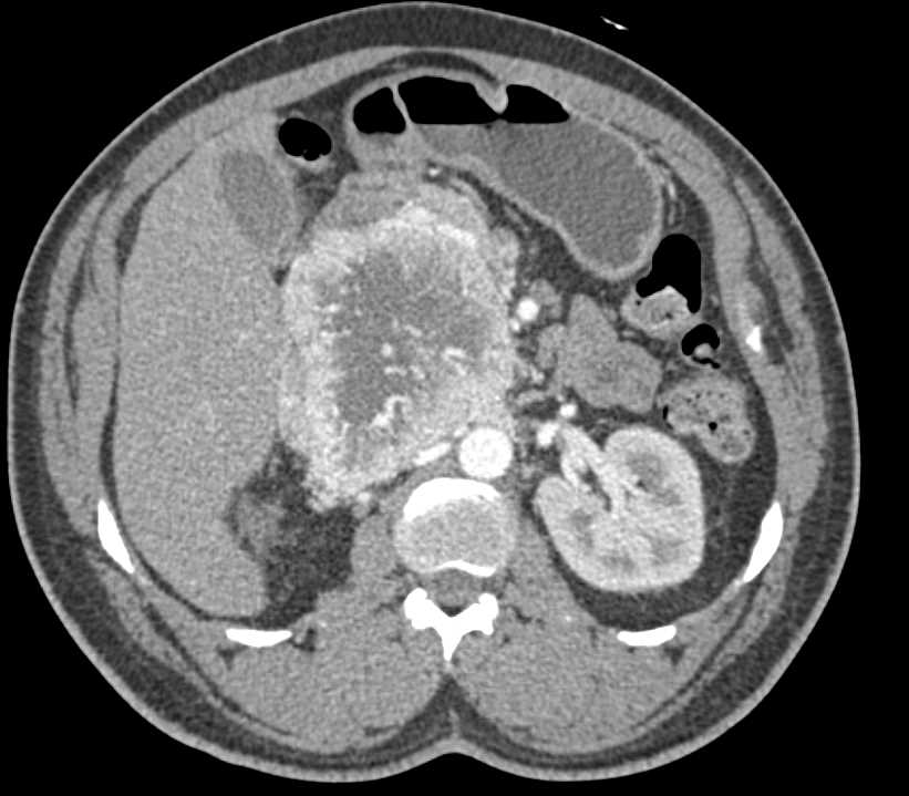 CTisus Case Studies