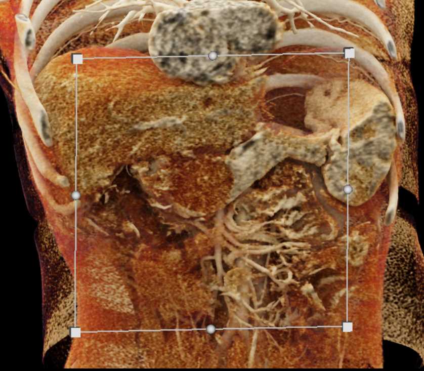 CTisus Case Studies