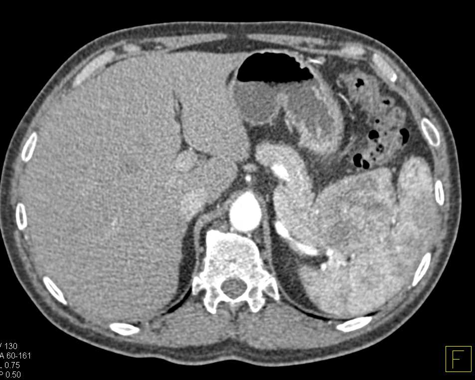CTisus Case Studies