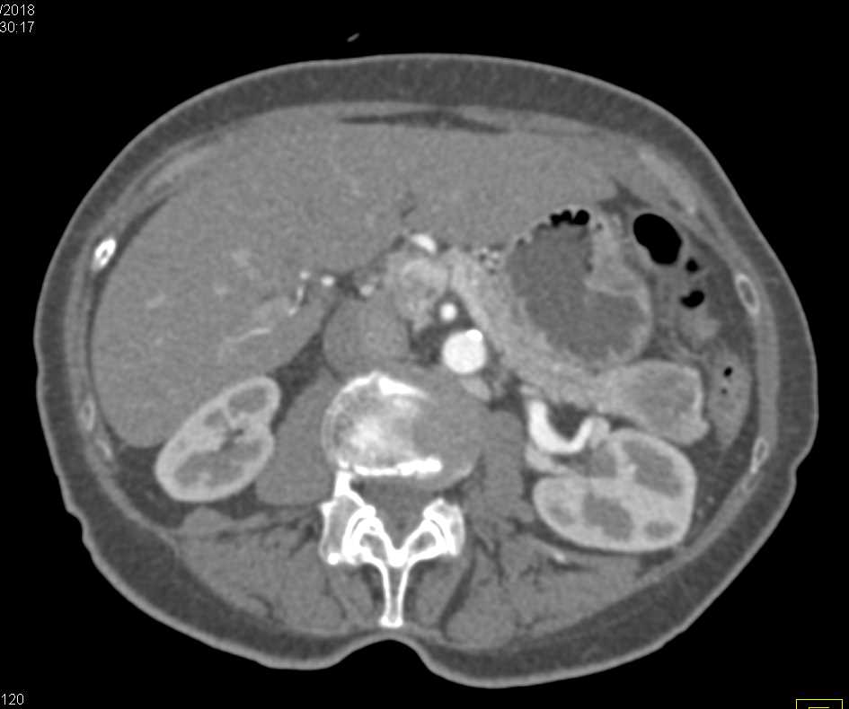 CTisus Case Studies