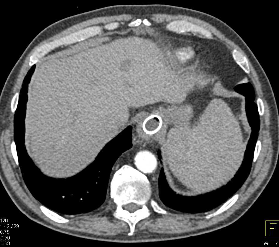 CTisus Case Studies