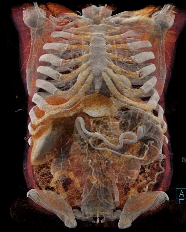 CTisus Case Studies
