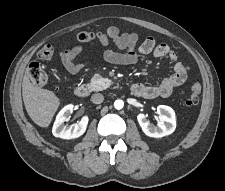 CTisus Case Studies