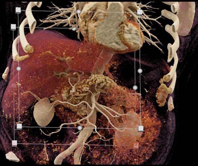 CTisus Case Studies