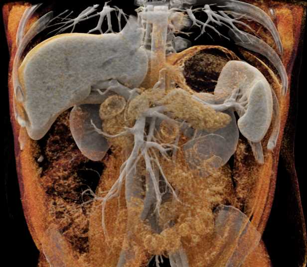 CTisus Case Studies