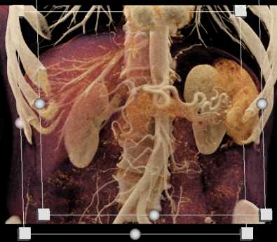 CTisus Case Studies