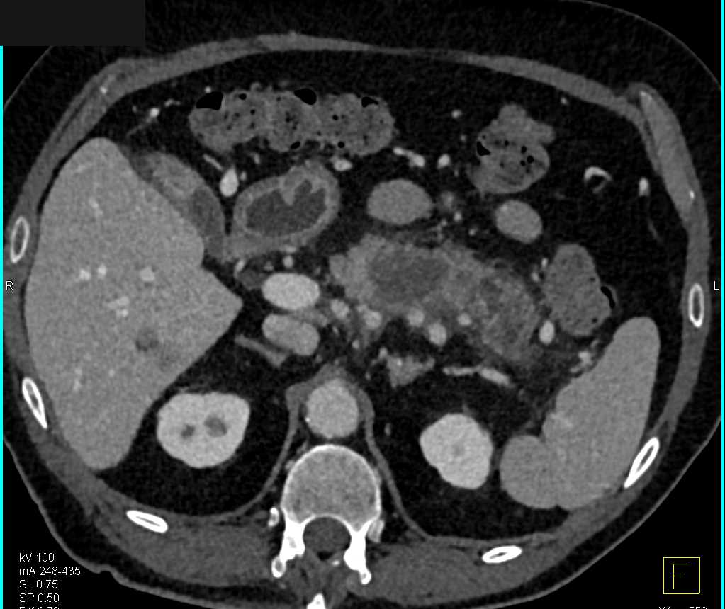 CTisus Case Studies