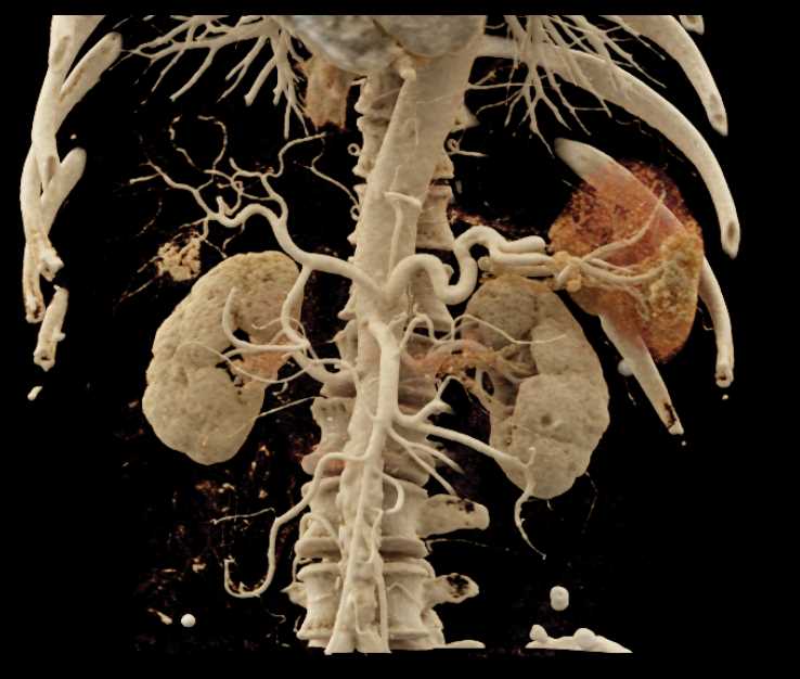 CTisus Case Studies