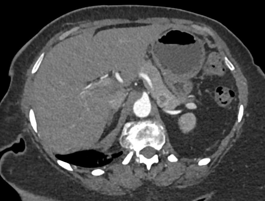 CTisus Case Studies