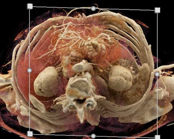 CTisus Case Studies