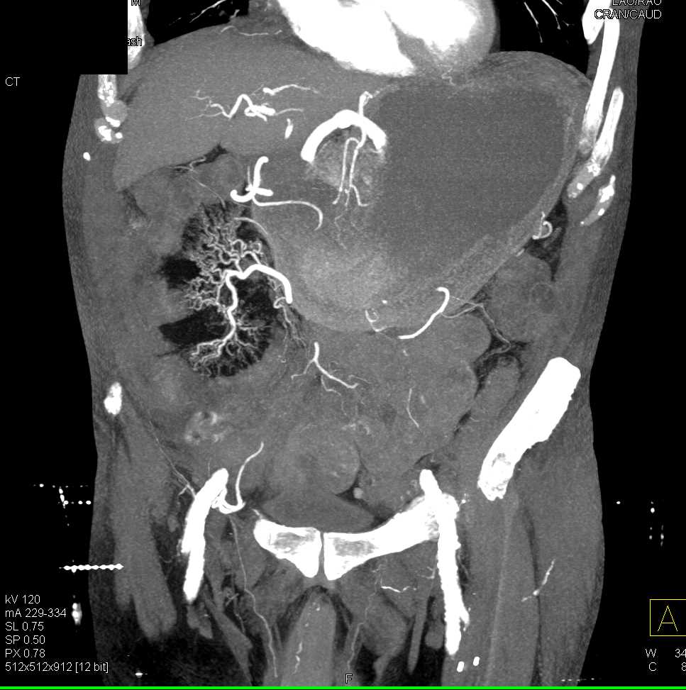 CTisus Case Studies