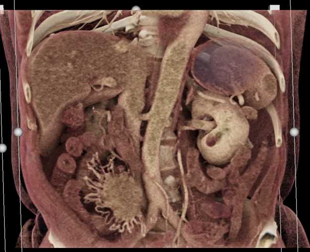 CTisus Case Studies