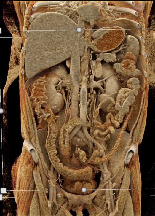 CTisus Case Studies