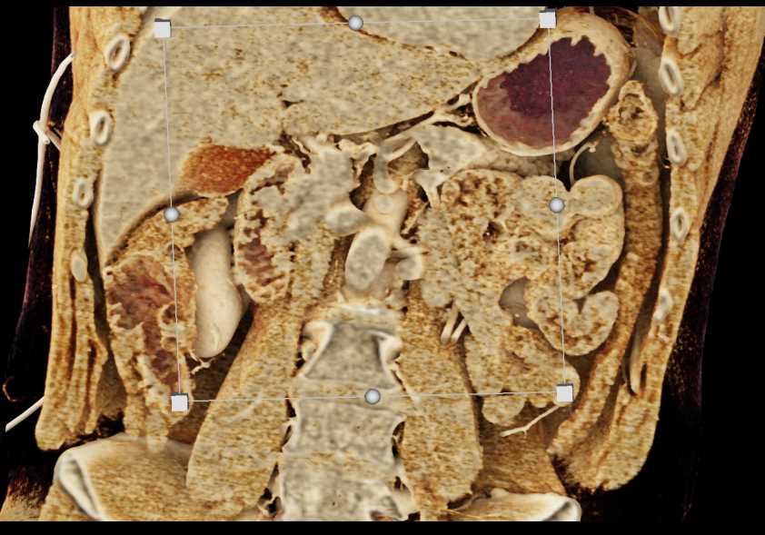 CTisus Case Studies