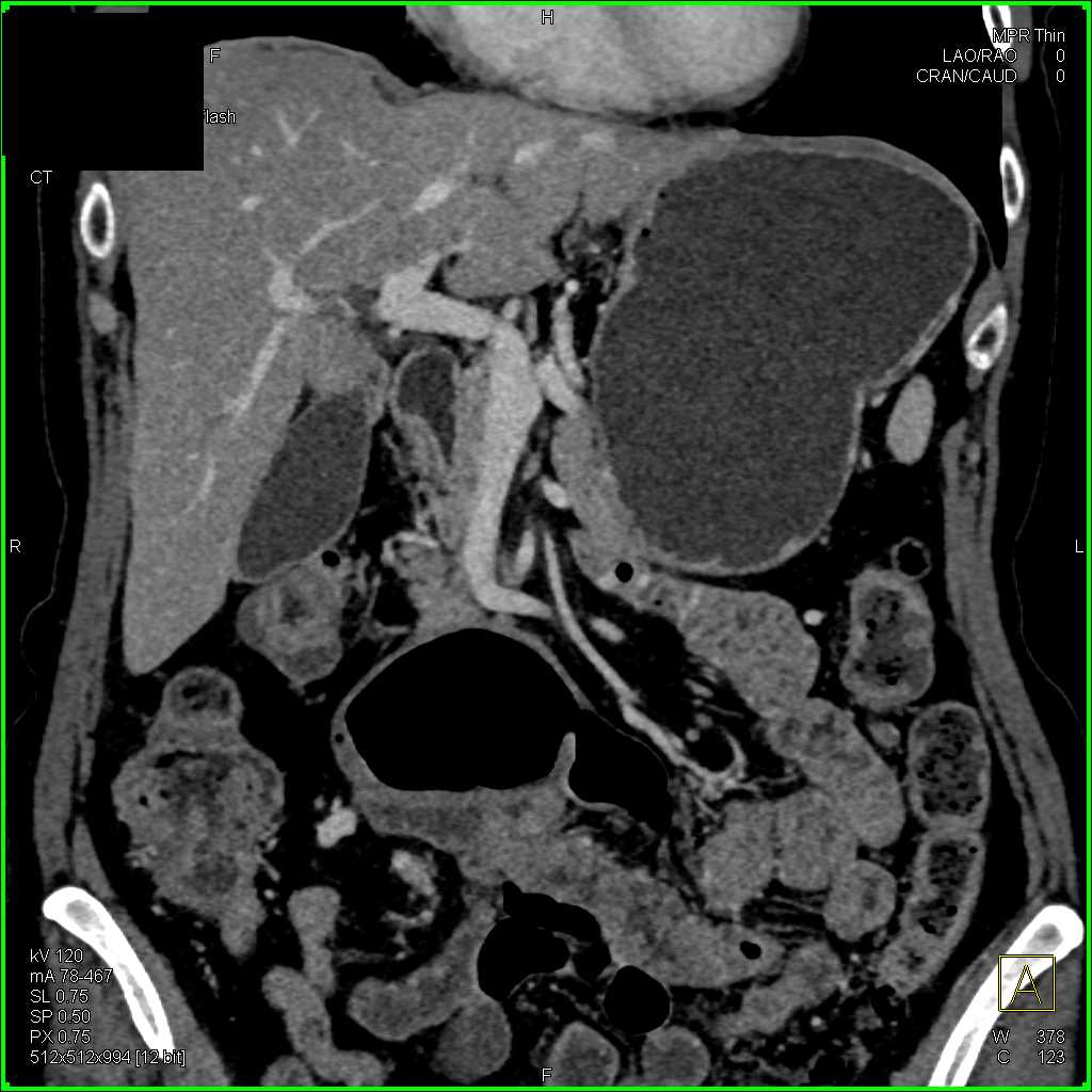 CTisus Case Studies