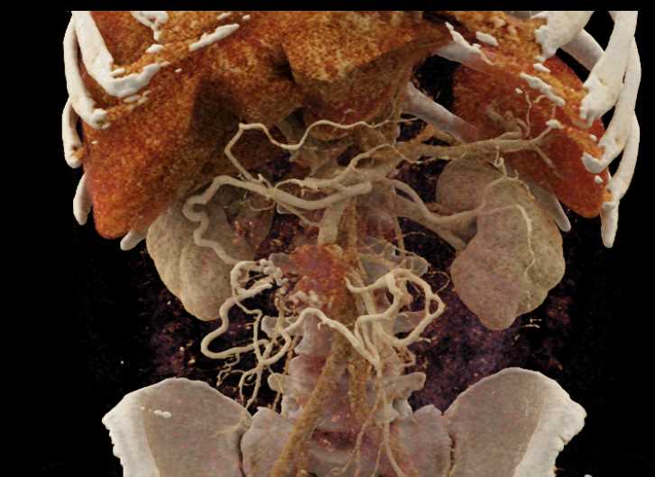 CTisus Case Studies
