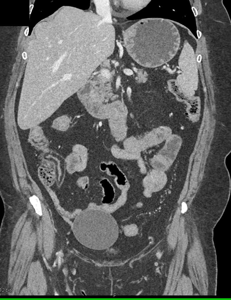 CTisus Case Studies