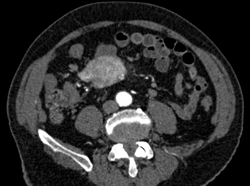 CTisus Case Studies