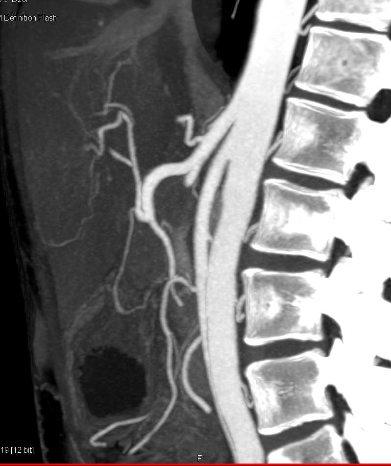 CTisus Case Studies
