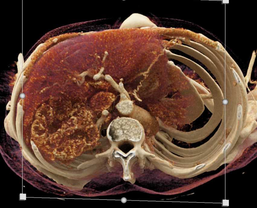 CTisus Case Studies