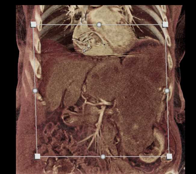 CTisus Case Studies