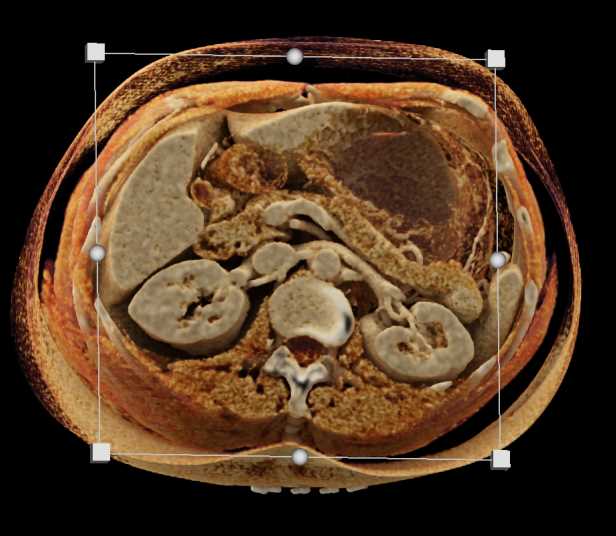 CTisus Case Studies
