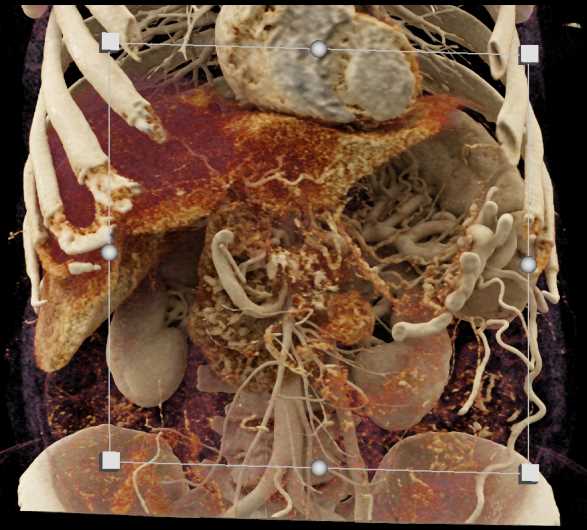 CTisus Case Studies